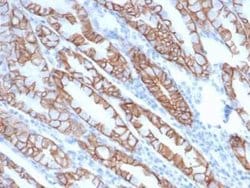 p120-catenin Mouse anti-Human, Clone: rCTNND1/6903, Novus Biologicals 100